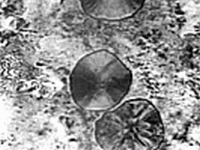 Unibar 700-2 (odpovídá EN-GJS-700-2)